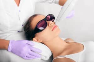 Procedure laser epilation for removing hair on face